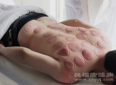 有的人在一次拔火罐后 有的人在一次拔火罐后